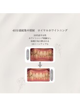 プラスビーセルフ(+b self)/ホワイトニングビフォーアフター