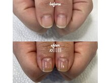 ネイルサロン ユーズ(USE.)/最強のネイルケア/自爪育成