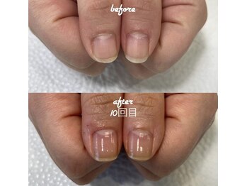 ネイルサロン ユーズ(USE.)/最強のネイルケア/自爪育成
