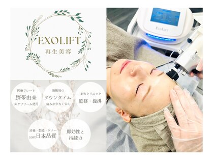 ジルフィー(GILFY)の写真