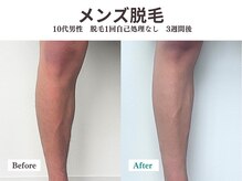 プレデト 天神店(PreDeto)の雰囲気（限定30名会員様に、今だけ脱毛月額無料キャンペーン実施中！）