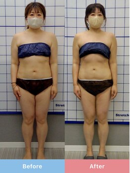 リスタート整体院 鹿児島(Restart整体院)/Restart痩身&ダイエット