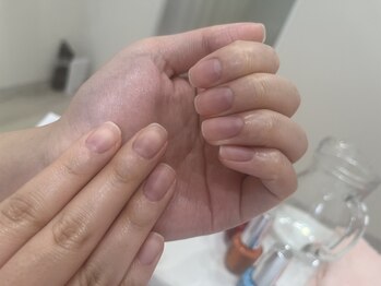 ネイルケア×ドイツ式フットケア専門Ruban 新宿御苑《ハンドケア/深爪/巻き爪》/