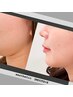 【マイクロニードル+超音波リフトアップ90分】　究極リフトアップ　￥9,000