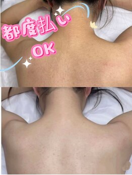 ブルーローズ(BLUE ROSE)の写真/【数十万の契約は勇気がいる・・】そんな方にこそ選んでほしい!完全都度払い制の脱毛サロン【脱毛/元町】