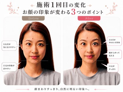 天空の手もみの写真