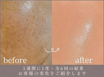 ピュアグレース 自由が丘の写真