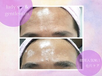 チャパン(Chapan)/韓国すっぴん美人＆毛穴ケア専門