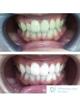 ファッシモ(fascimo)/お客様のbefore & after