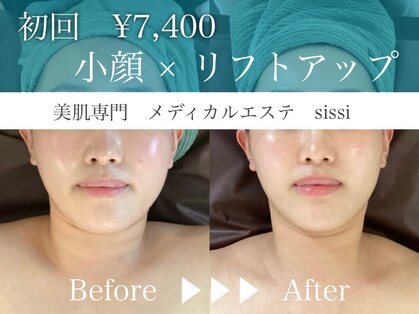 シシィ 二子玉川(sissi)の写真