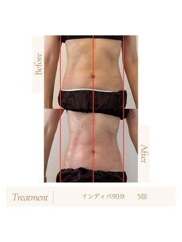 ルソール(Le seul)/冷え・便秘に腹部インディバ