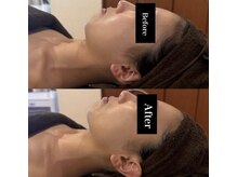 小顔矯正もお任せ下さい♪