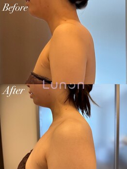 ルノン(Lunon)/【巻き肩/肩こり】肩甲骨はがし