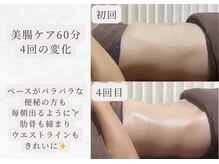 エイル(Eir.)/【腸もみ】before/after