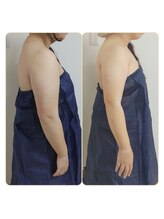 アンティクイーン(Antiqueen)/二の腕スッキリ