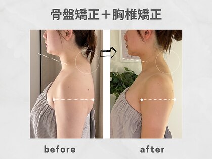 ビトリア 小顔 骨盤美容矯正サロン(BITORIA)の写真