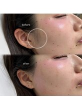 レアファースト/もみあげワックス