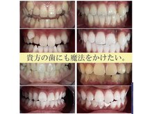 ライトビューティー 本八幡店(LIGHT BEAUTY)/お客様ビフォーアフター♪ 