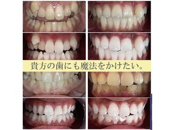 ライトビューティー 本八幡店(LIGHT BEAUTY)/お客様ビフォーアフター♪ 