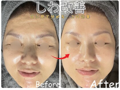 エレ(ele)の写真