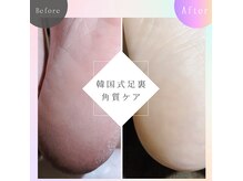 プレヴナンス(Prevenance)