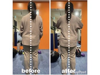 カワル整体 上通り院/ストレスで姿勢悪い人