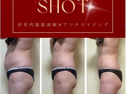 ビメガミ(美 MEGAMI)の写真