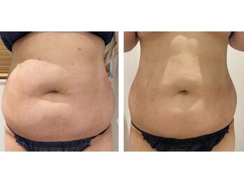 ルナグランデ(Luna grande.)/効果写真