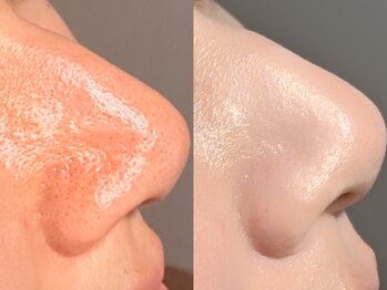 ルーナジェーナ(Luna llena)/池袋 エステ ルーナジェーナ