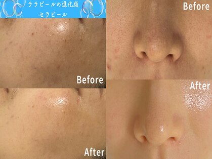 ホロホロ(holoholo)の写真