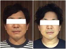 美容整体 ウェリナ 蟹江院/小顔矯正/骨盤矯正/美脚サロン 