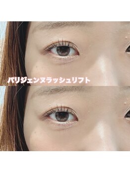 レディエント(Radiant)/パリジェンヌラッシュリフト