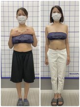 リスタート整体院 鹿児島(Restart整体院)/Restart痩身&ダイエット