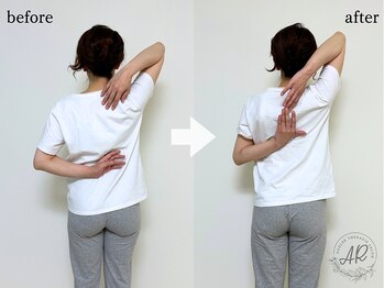 エーアール(AR)/【Before/After】2回目