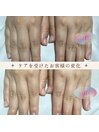 ハンドプロスパ/Before After
