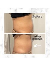 ザビューティー 麻布十番本店(The Beauty)/12Dリフトお腹美くびれ[リフト]