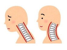 くまのみ整骨院 蕨川口芝院/スマホPCの使い過ぎに！