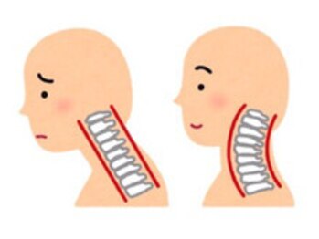 くまのみ整骨院 蕨川口芝院/スマホPCの使い過ぎに！