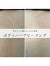 【背中・二の腕のニキビの記憶抹消】ボディハーブ　17700円→13500円