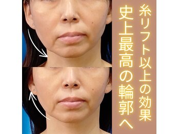 目元 口元のたるみ 眉間シワ改善専門サロン
