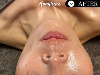 アングレイス(Anngrace)/【リリースカッター】/After