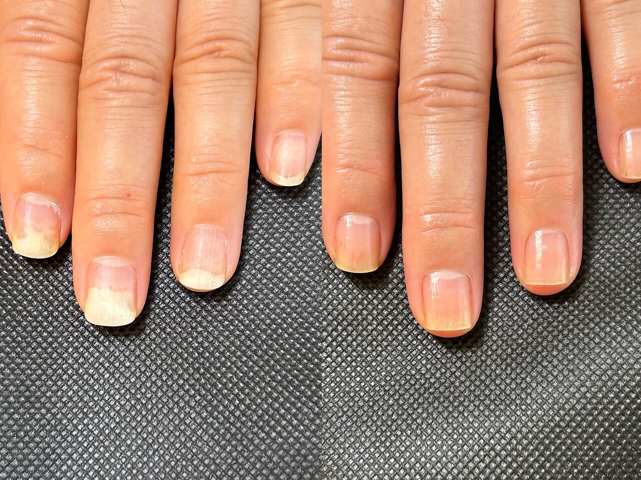 フォト｜アミカ ネイル(amica nail)｜ホットペッパービューティー