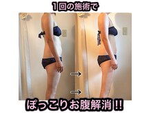 エターナルボーテ(Eternelle Beaute)の雰囲気(施術後の効果を実感してください!)