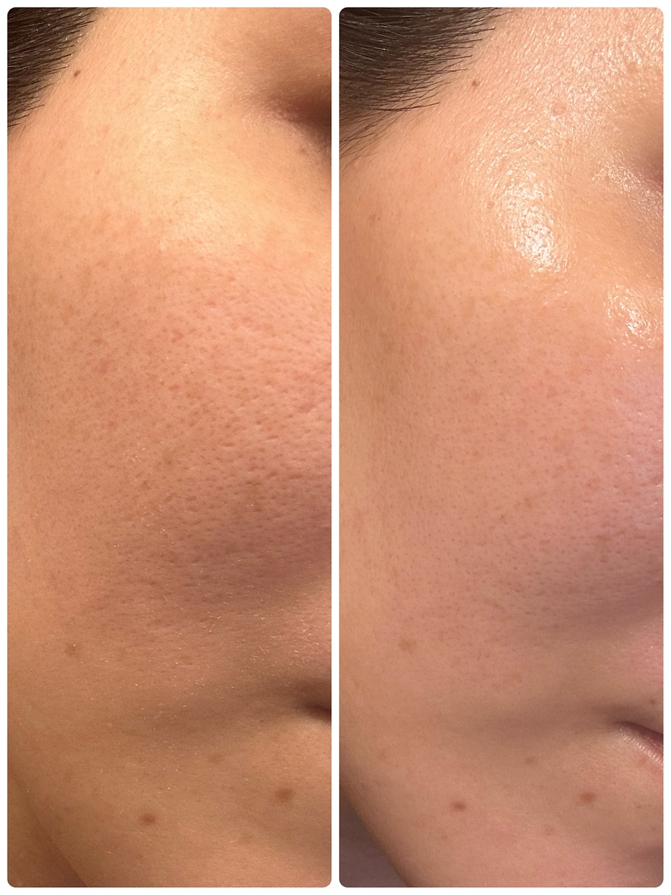 シャナ(Shana)/ラミネーションピール