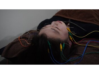 リベルタ鍼灸整骨院 なんば店(Liberta鍼灸整骨院)/美容鍼/食いしばり・眼精疲労に!