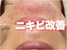 オーノ(Ohno)の雰囲気（産毛を除去するだけではなく、肌質を変えるからこそ結果に繋がる）