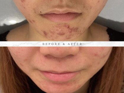 ナスサロの写真