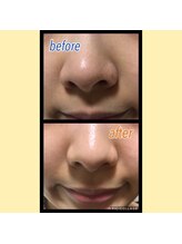 ドマーニプラス 泉店(DOMANI PLUS.)/毛穴ケア