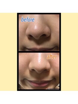 ドマーニプラス 泉店(DOMANI PLUS.)/毛穴ケア