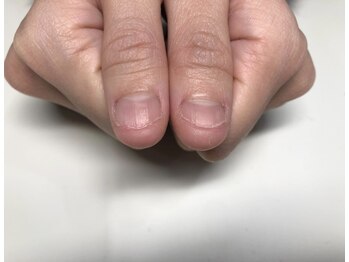 ヴェールリム(verl lim)/